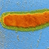 Infecção por Vibrio vulnificus